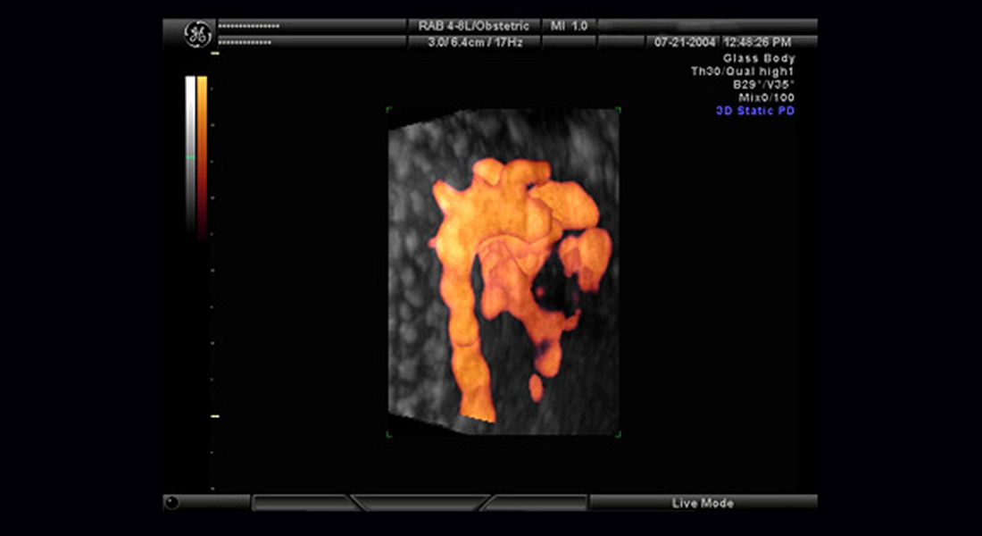 3D Gallery AIC scan